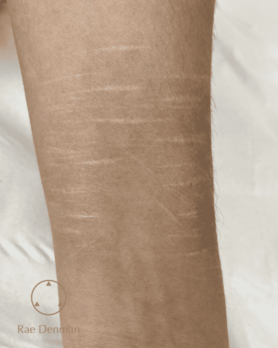 scar camouflage