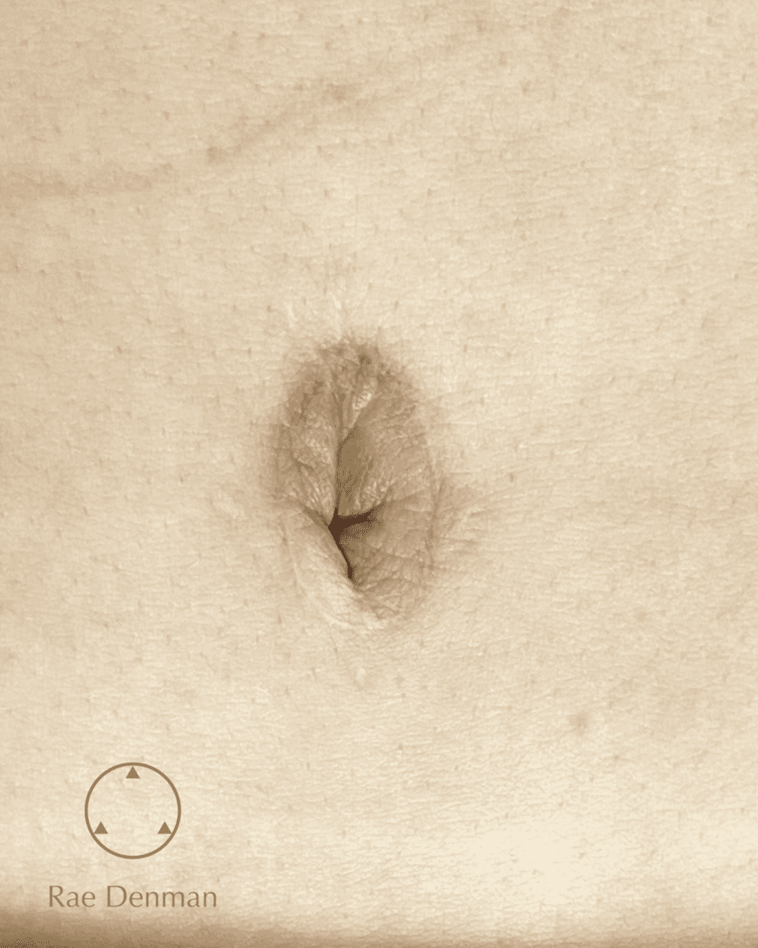 medical tattooing for scars after