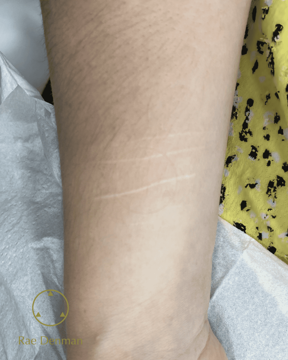 scar camouflage