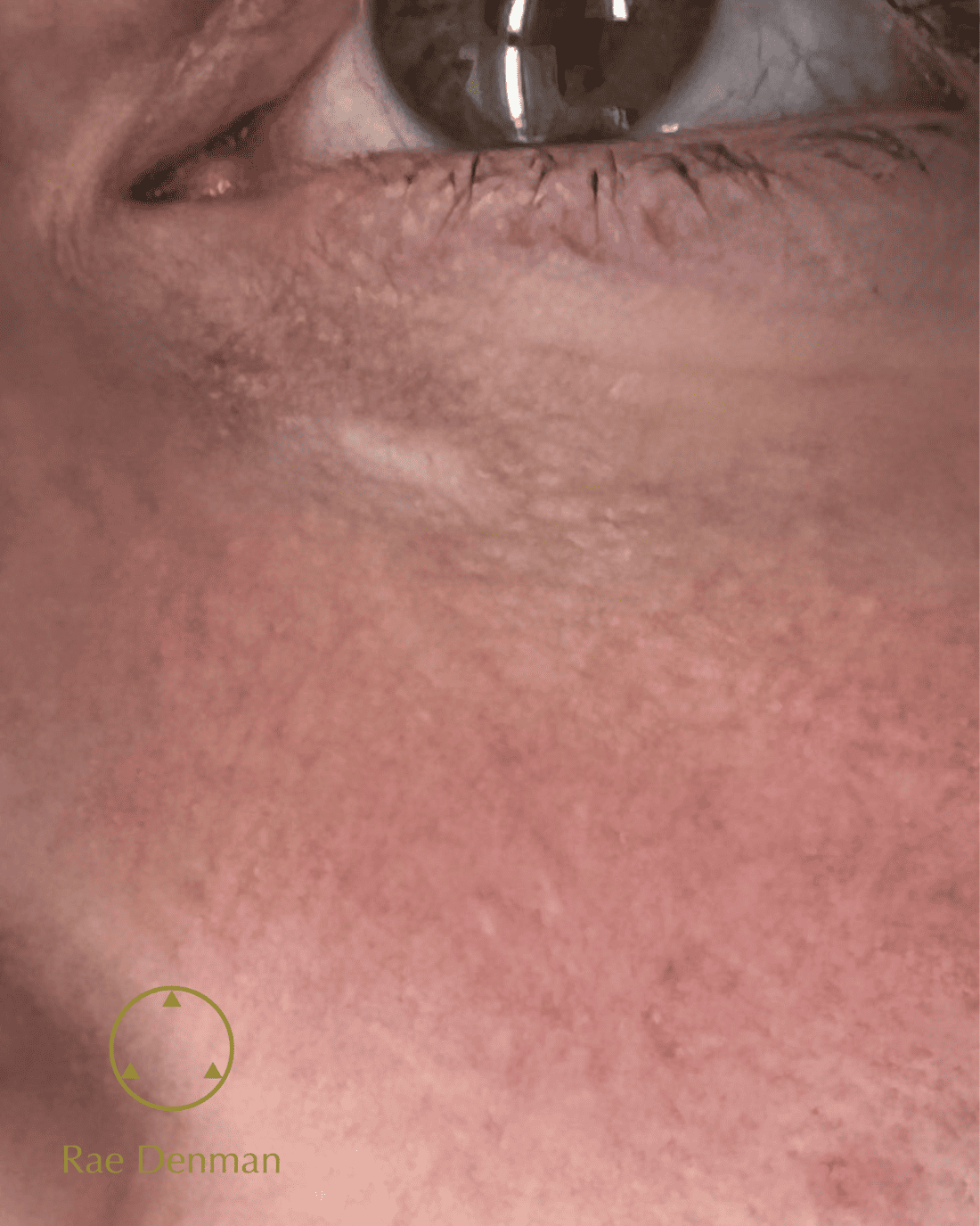 scar camouflage
