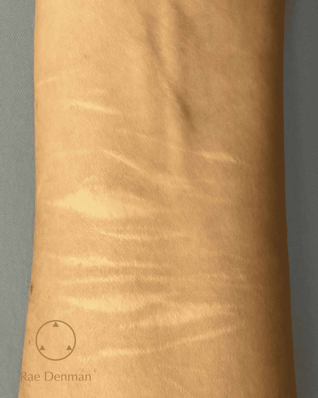 medical tattooing for scars before