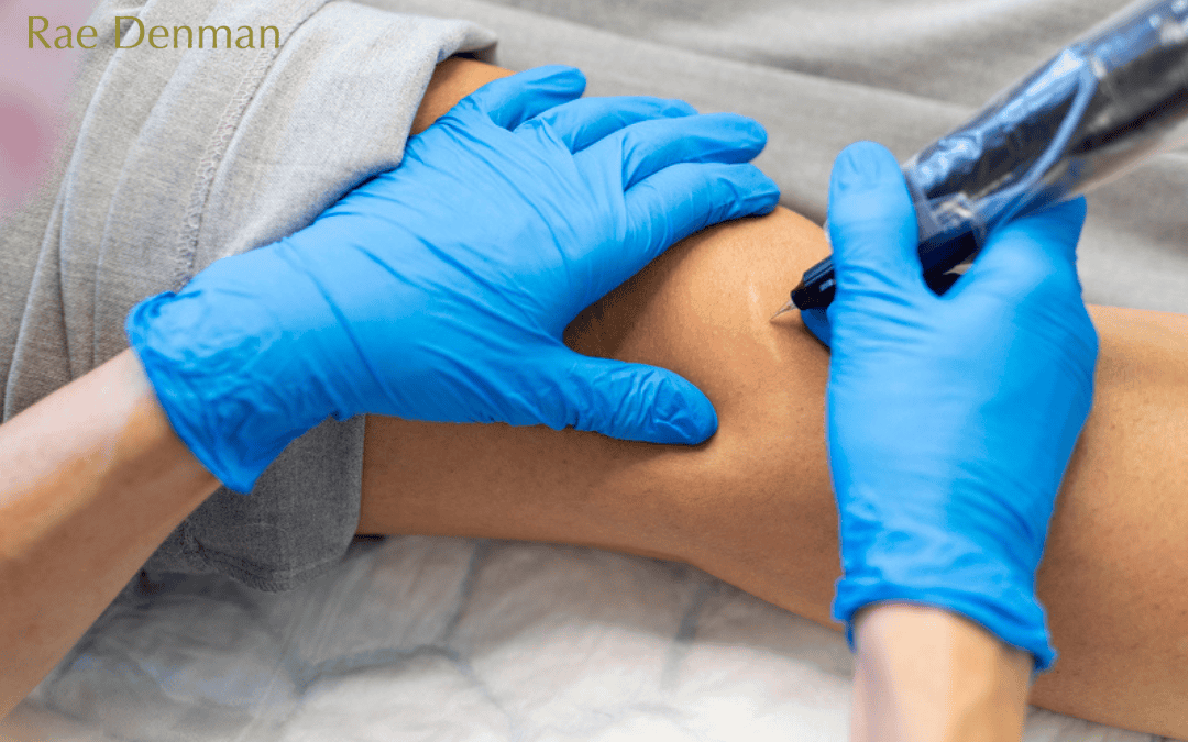 Understanding Scar Camouflage Tattooing