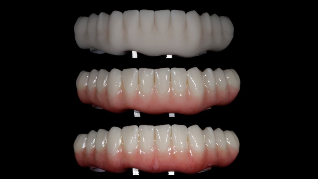 Step-by-step glazing and characterization of 3d printed All-on-X implant