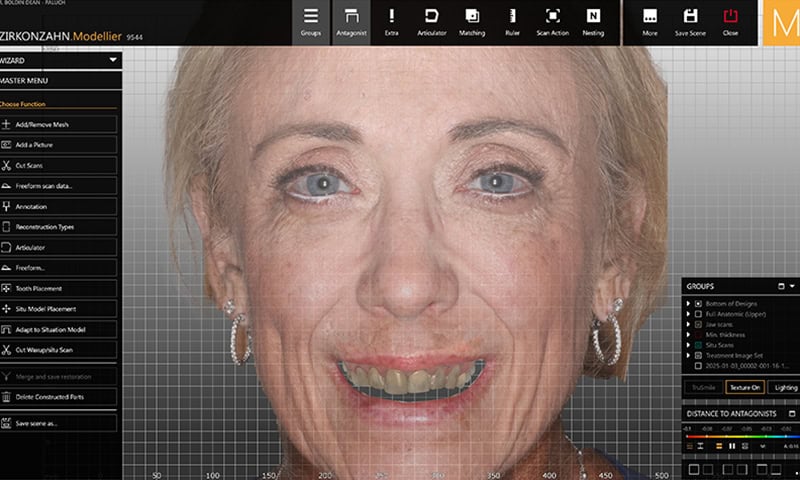 Scan of patient’s smile before treatment