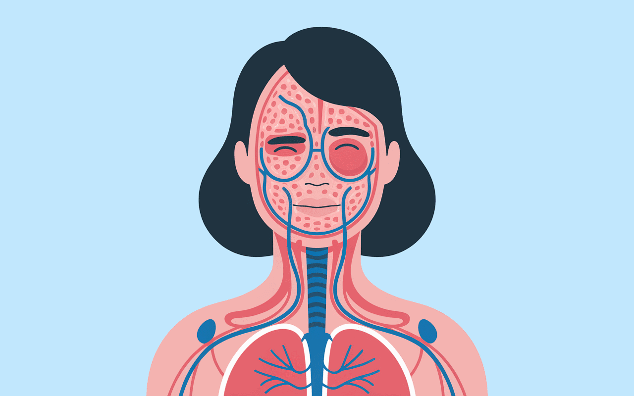 comment enlever la cellulite des cuisses schéma explication médicale