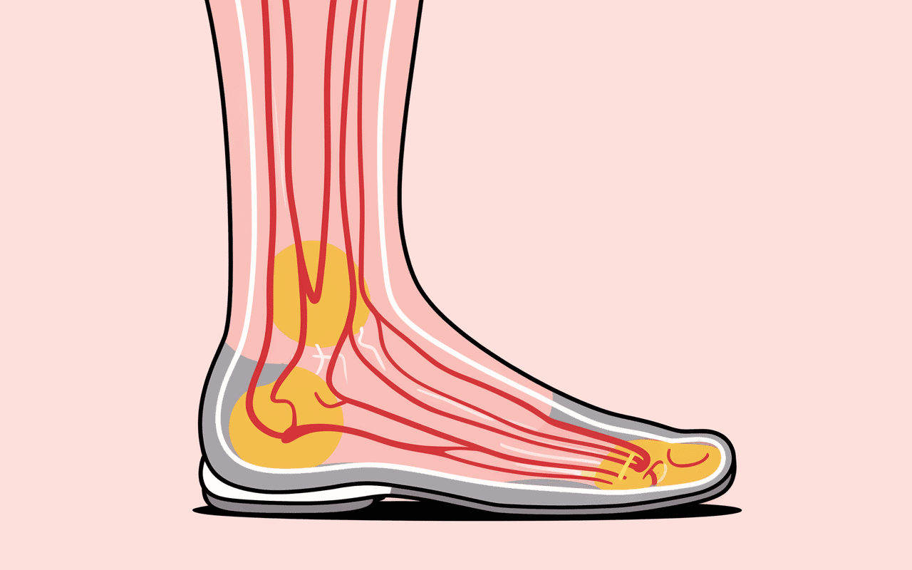 Schéma anatomique douleur pied nerf sural origine