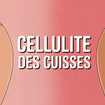 comment enlever la cellulite des cuisses visuel titre