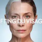 lifting visage avant après visage femme