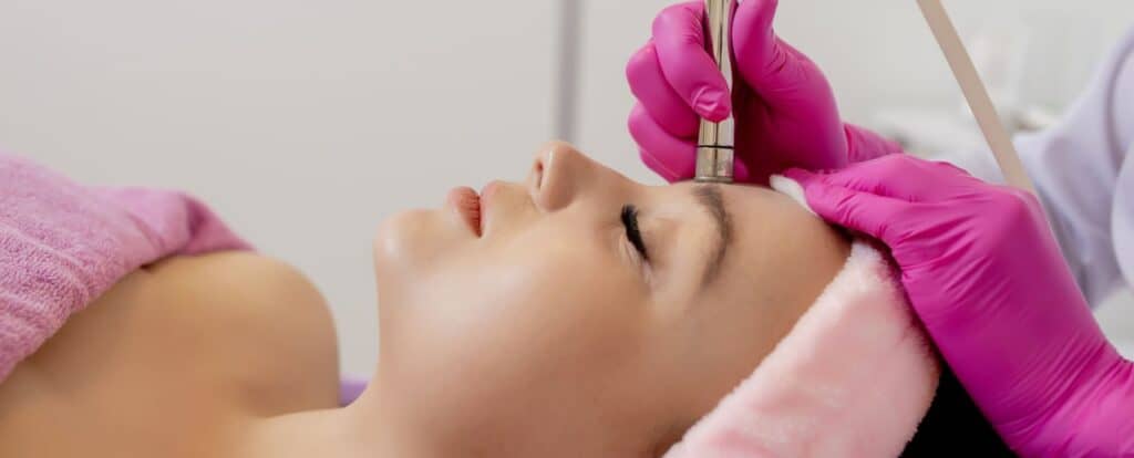 Tratamiento con Microdermoabrasión