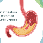 temps de cicatrisation estomac après bypass illustration médicale