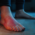 algodystrophie du pied traitement illustration phases