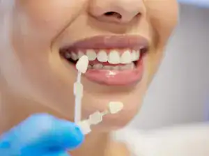 porcelain veneers near me