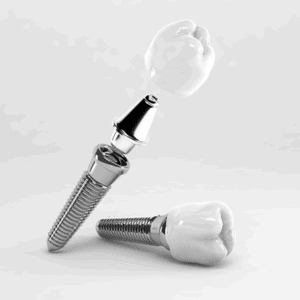 dental implants