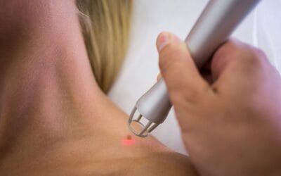 Cercate un dermatologo laser a Milano? Ecco perché contattare lo Studio Dermatologico Bianchi