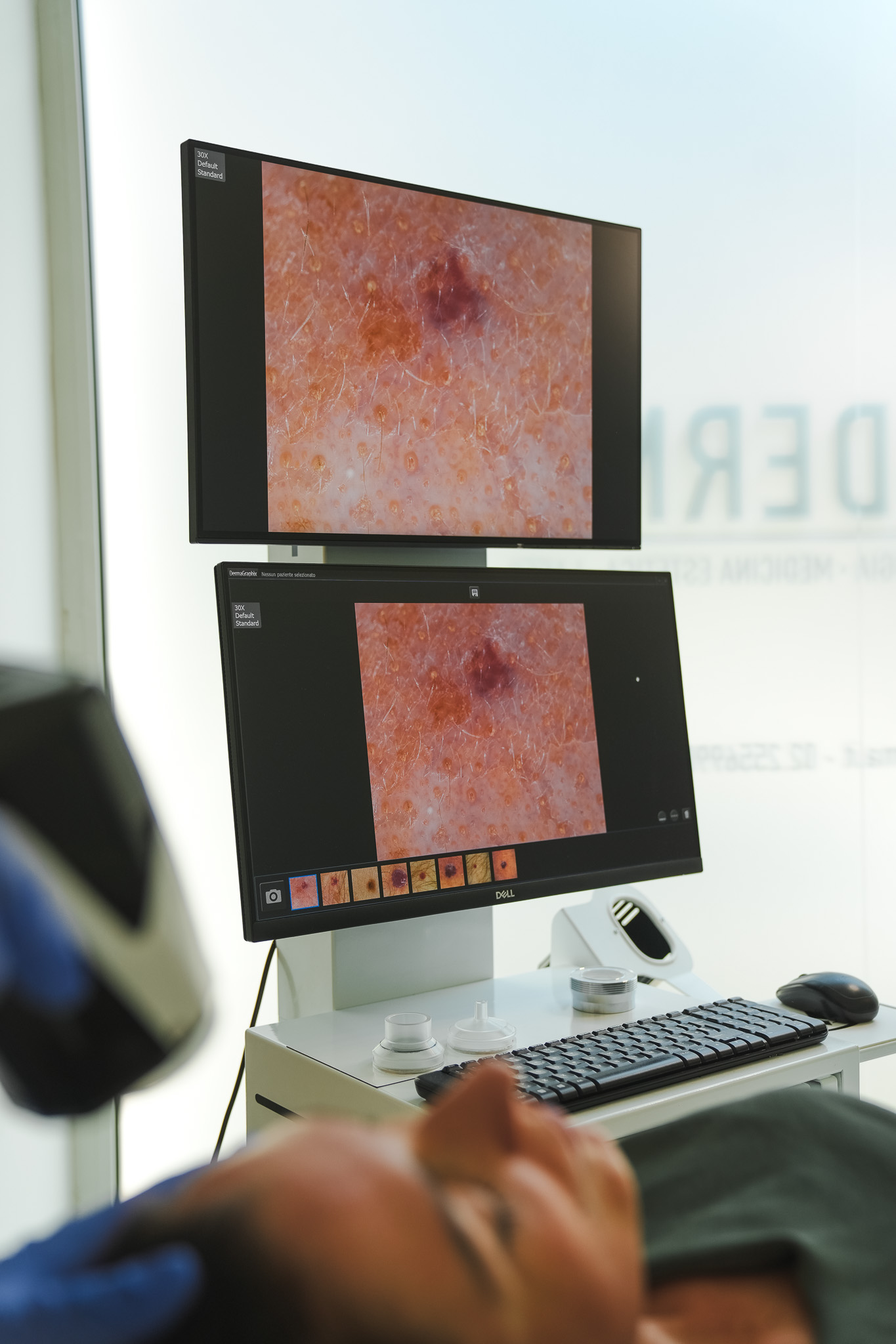 Visita dermatologica