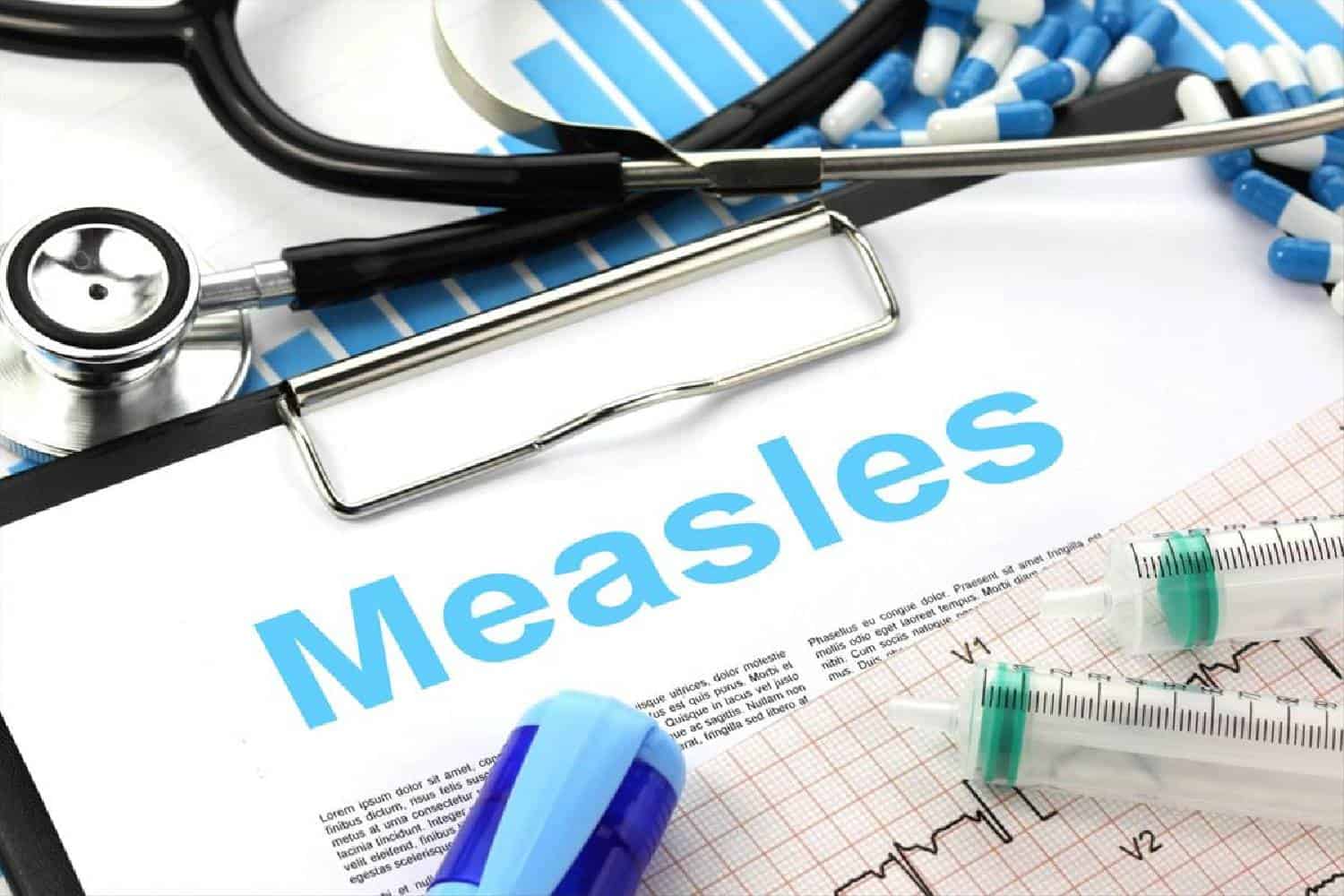 measles outbreak limpopo