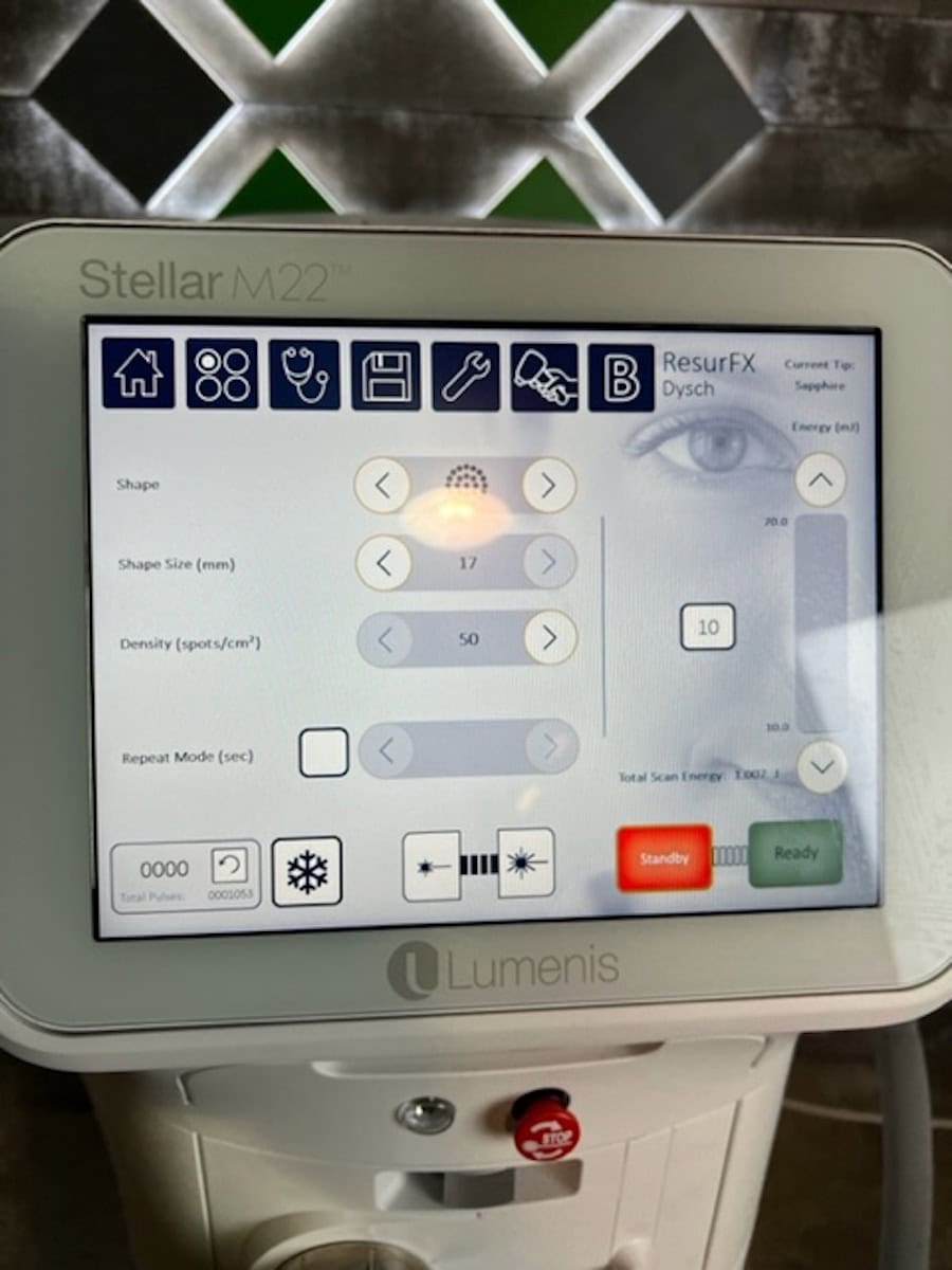 2022 Lumenis Stellar M22 - Features