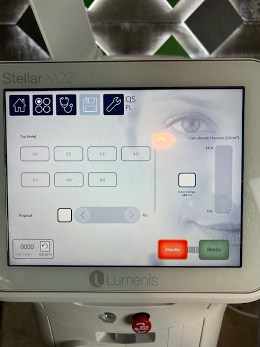 2022 Lumenis Stellar M22 - Display