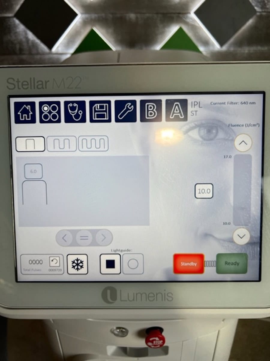 2022 Lumenis Stellar M22