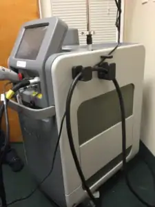 Used-Laser-Equipment-that-needs-a-service