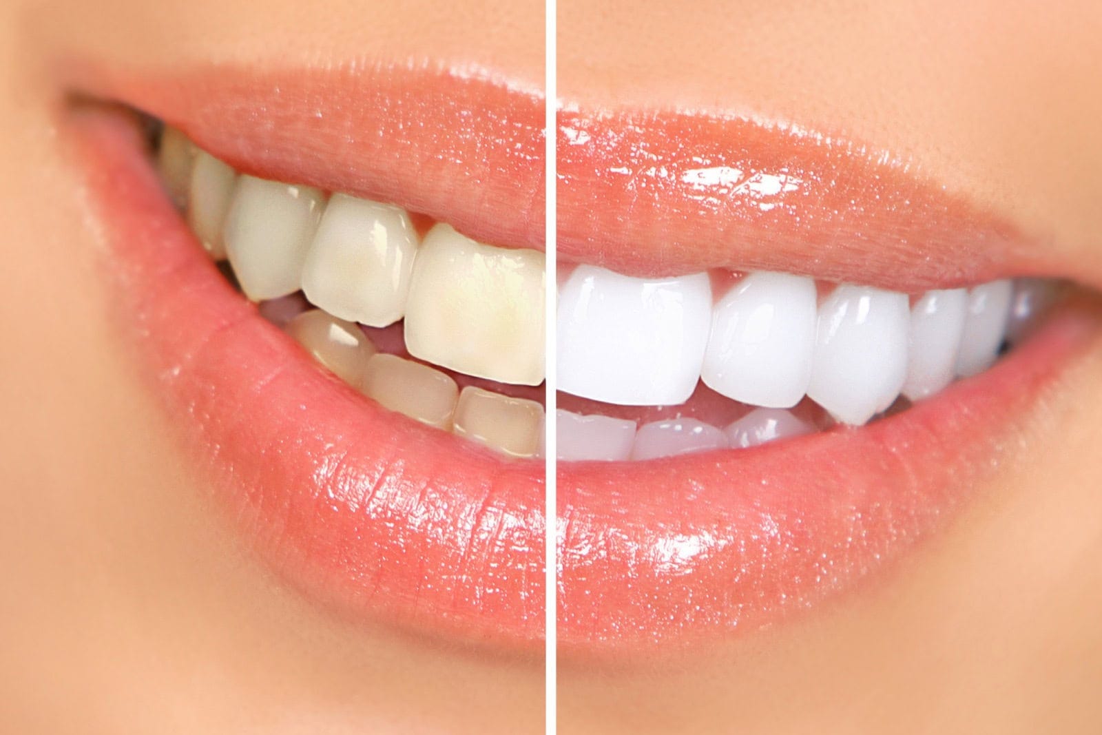 Smiling woman mouth with great teeth. Over white background