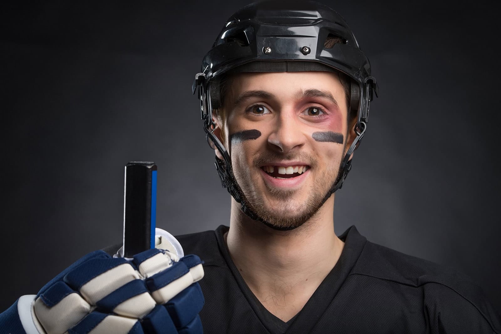 A sports player with a knocked-out tooth