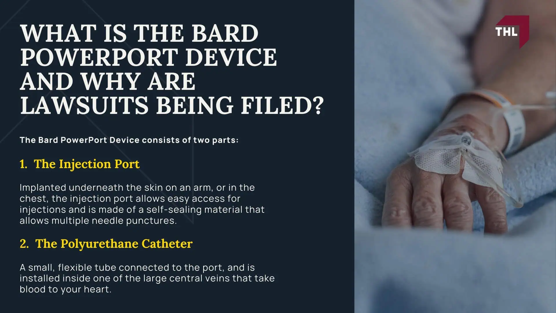 Breast Mesh Lawsuit - What Bard PowerPort Devices are Named in the Lawsuit_ - torhoerman law; Breast Mesh Lawsuit - Bard PowerPort Lawsuit Updates and Overview - torhoerman law; Breast Mesh Lawsuit - What Is the Bard PowerPort Device and Why Are Lawsuits Being Filed_ - torhoerman law