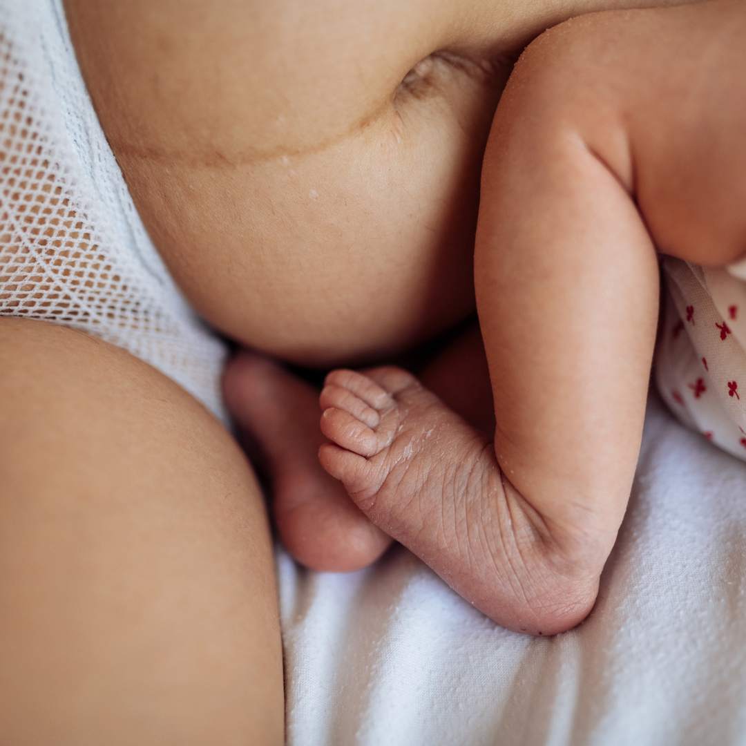 what to expect after vaginal birth