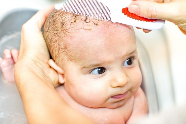 Cradle cap treatment