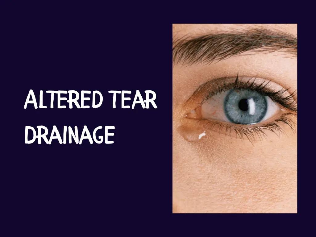 altered tear drainage