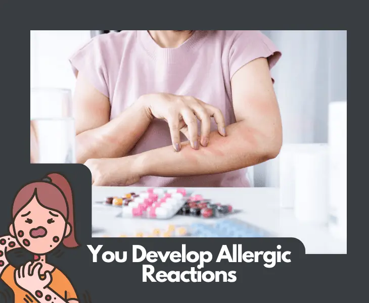 you develop allergic reactions