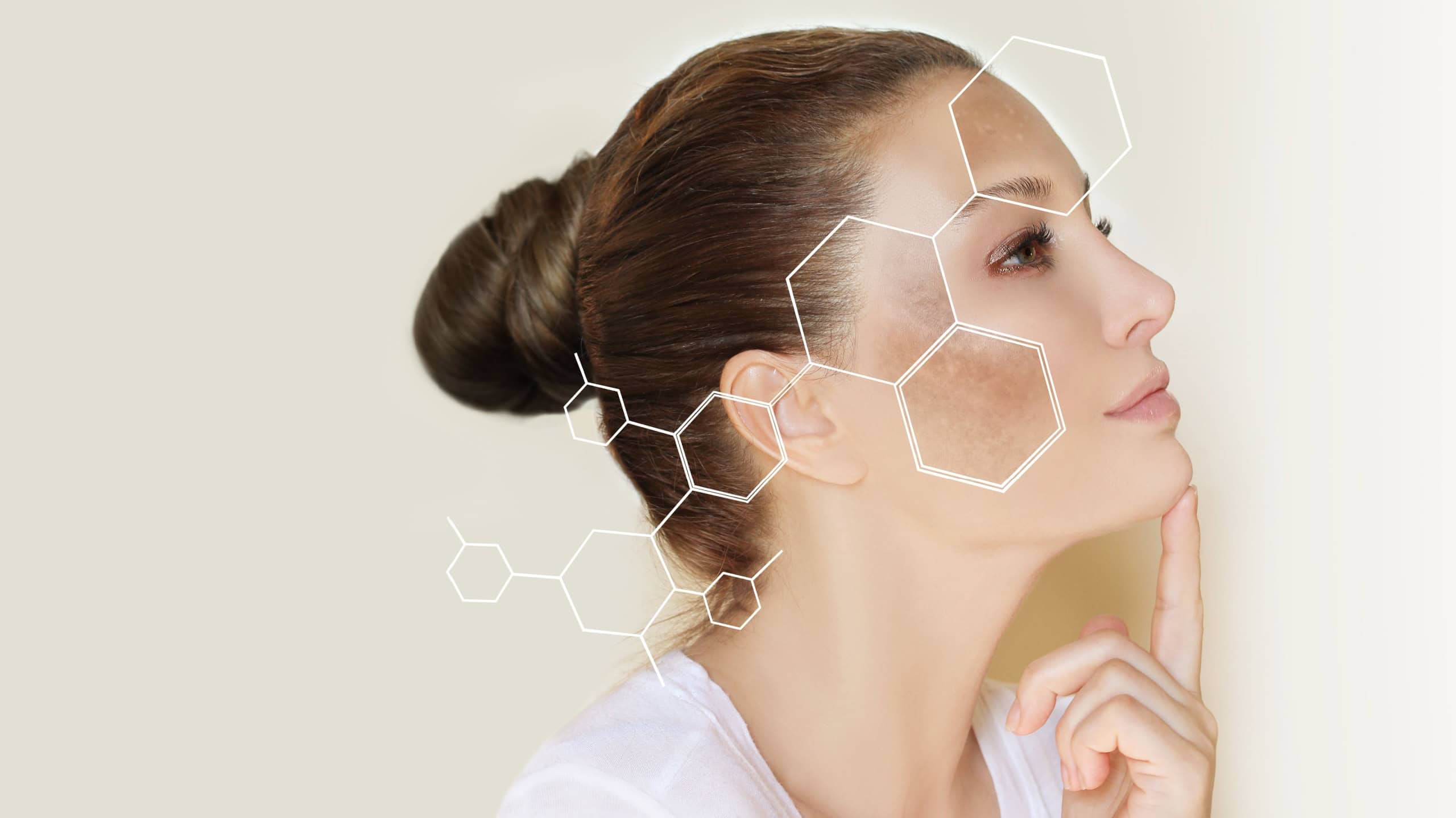 Dark spots, freckles,hyperpigmentation(melasma or chloasma),concept - skin lightening, skin whitening, fruit acids,AHA, Skin Brightening