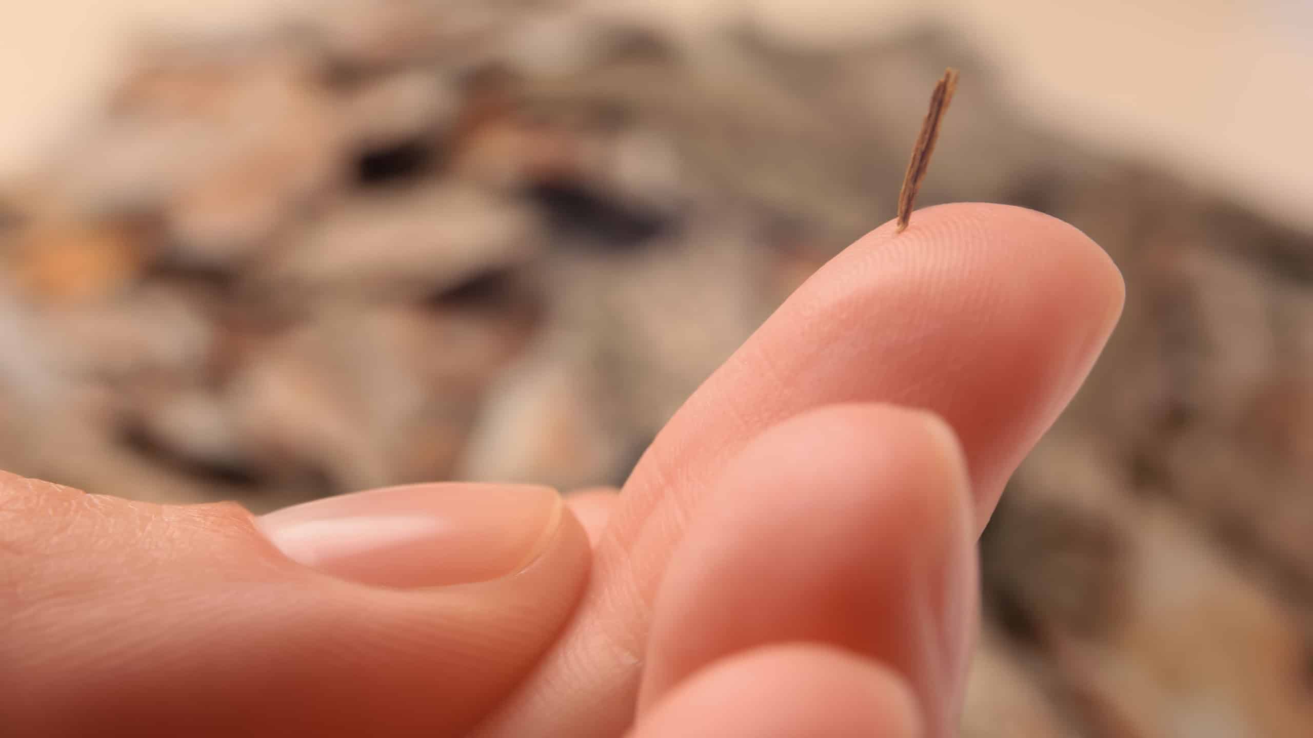 Woman with splinter in her finger on blurred background, closeup