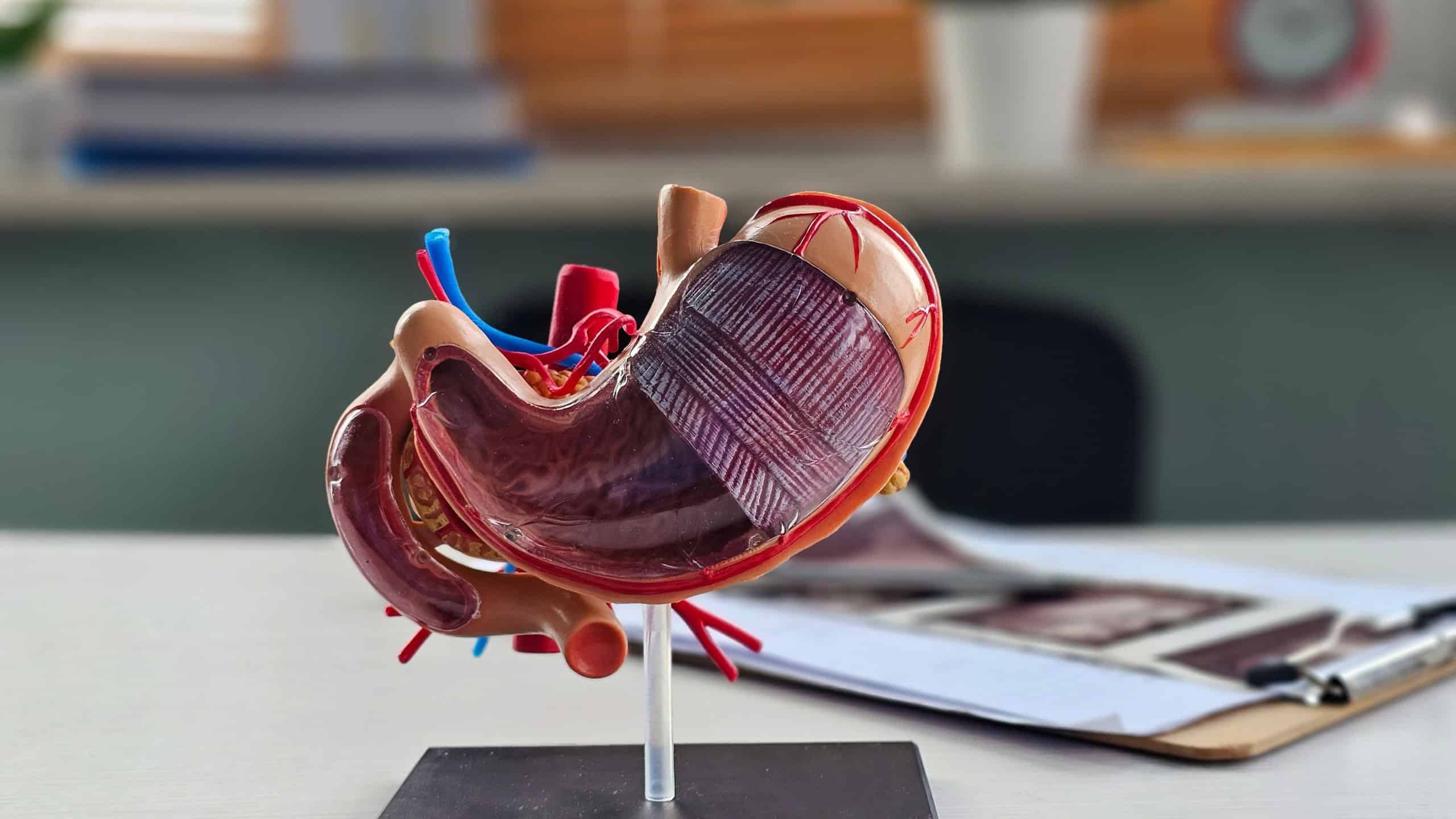 Model of stomach and problem of stomach ulcer, intestinal cyst and oncology and examination