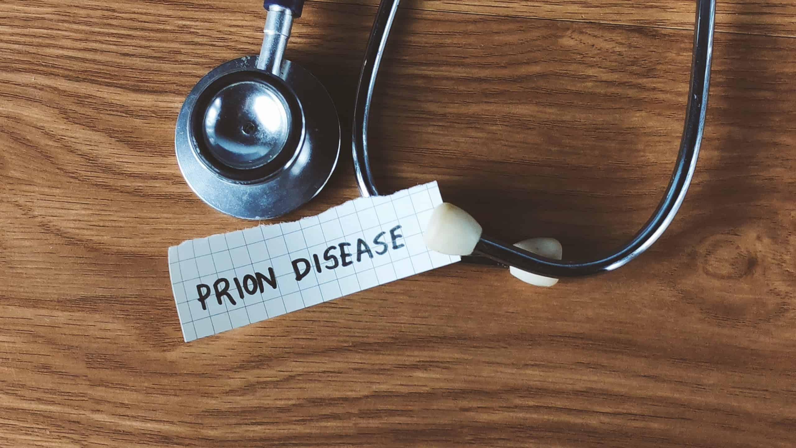 Stethoscope and Note Reading "Prion Disease" on Wooden Desk for Medical Research