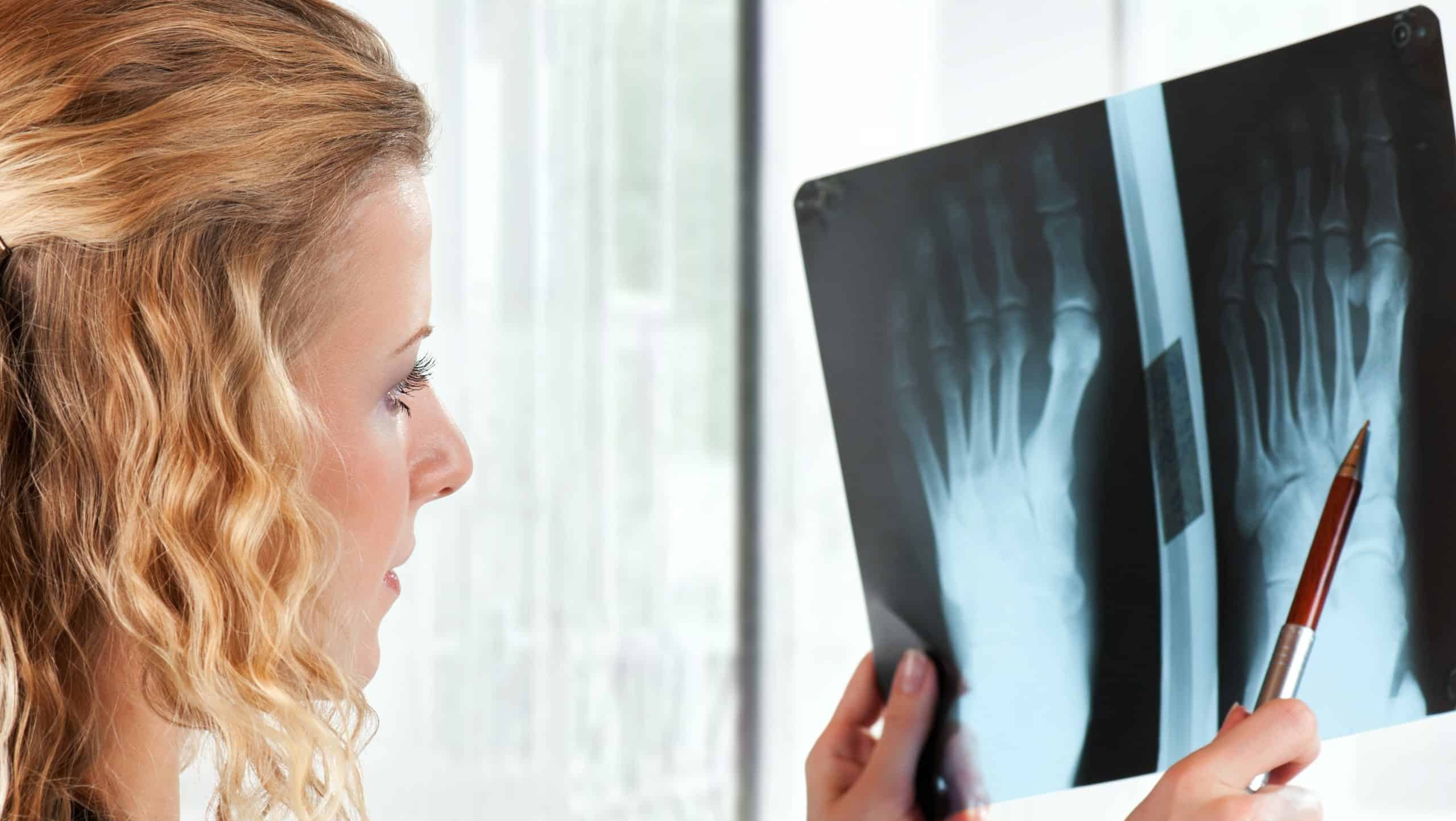 Medical,Doctor,Analysing,X-ray,Photography,In,Hospital