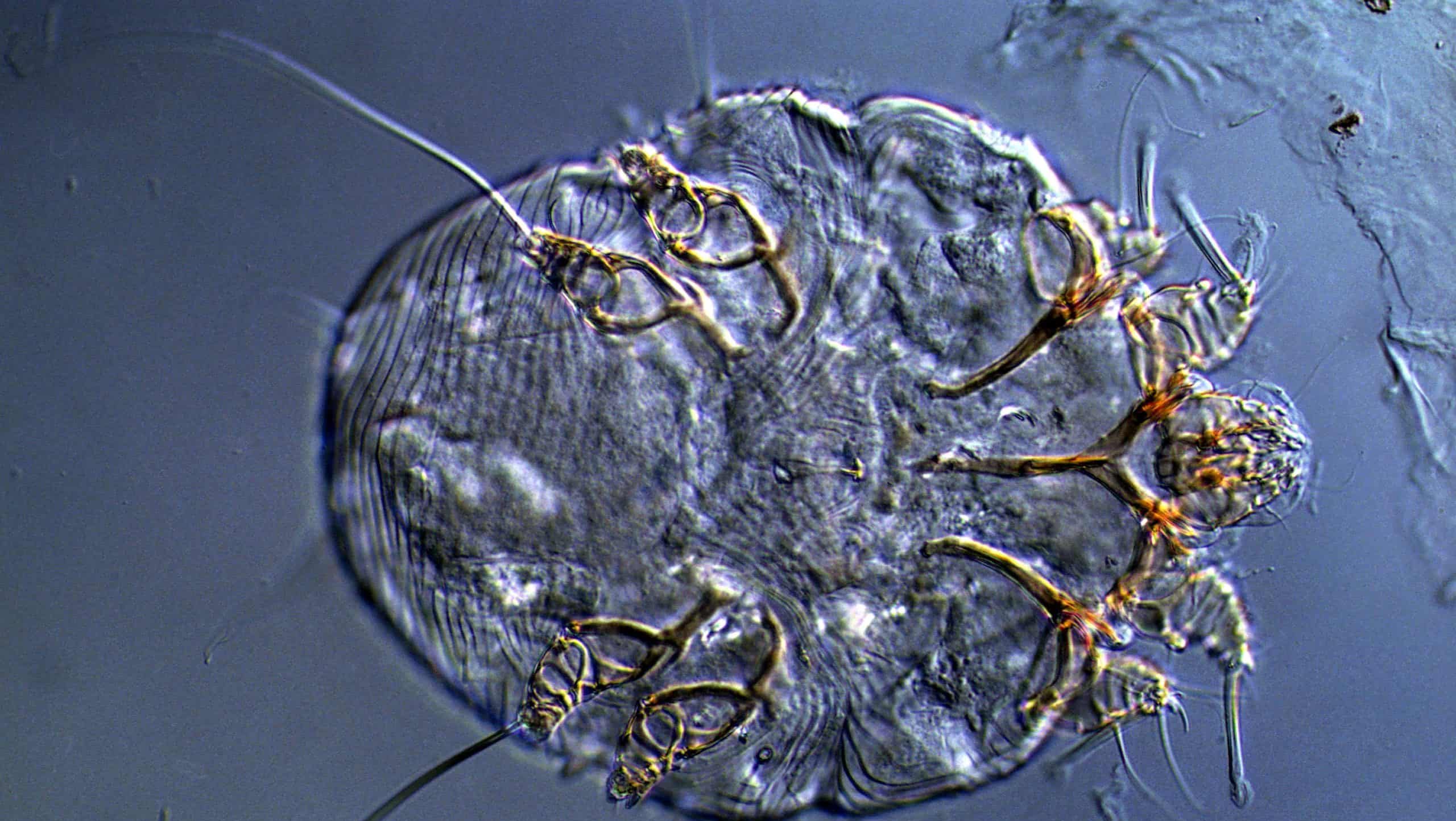 Sarcoptes scabiei mites