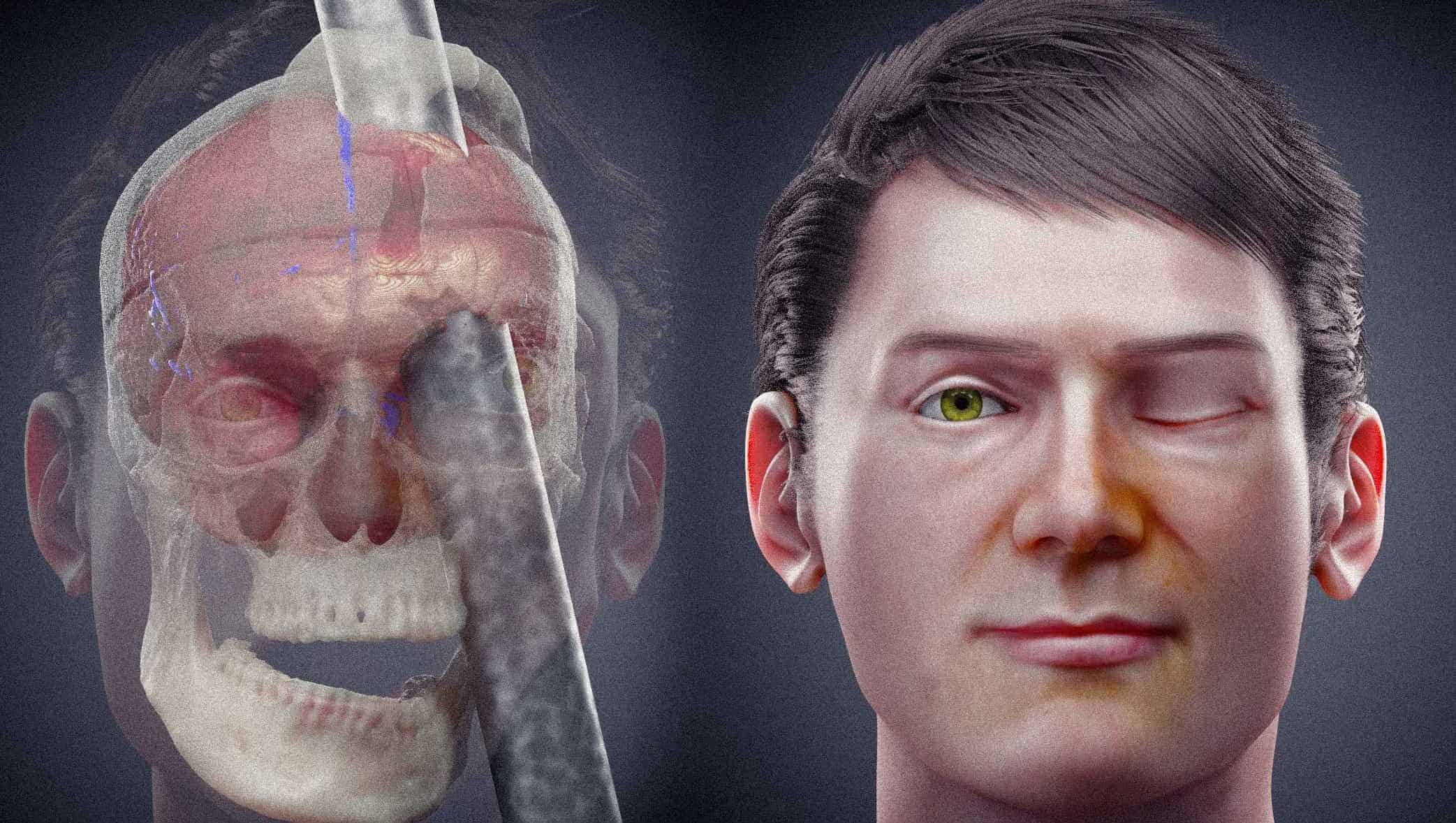 Phineas Gage