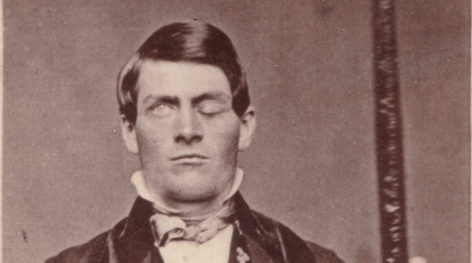 Phineas Gage