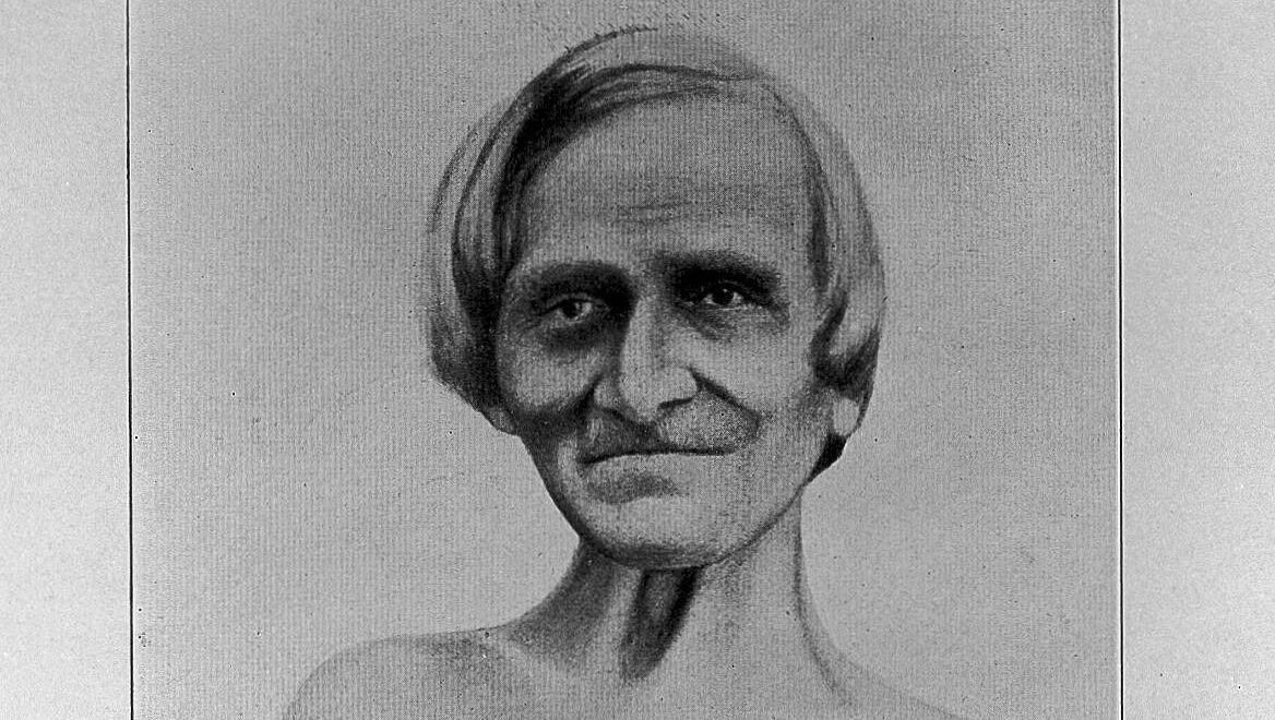 Alexis St. Martin