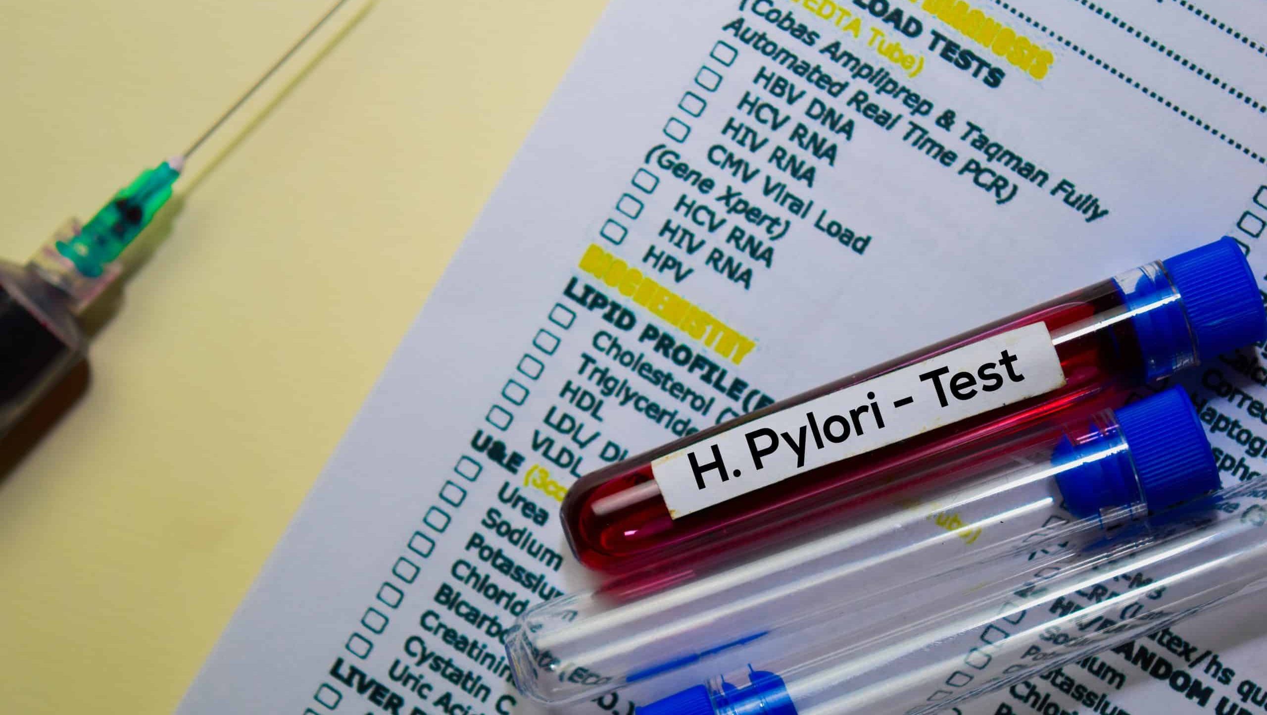 H.,Pylori,-,Test,With,Blood,Sample.,Top,View,Isolated