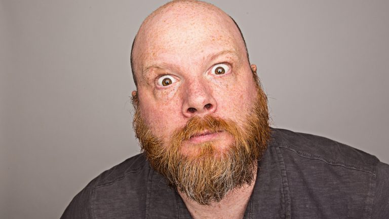 wild eyed bald man with full red beard
