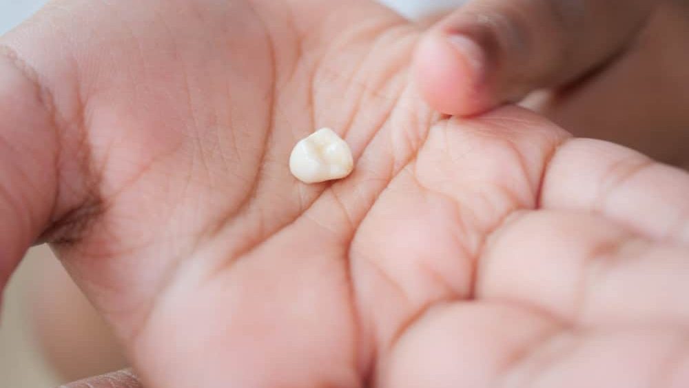 Lost tooth