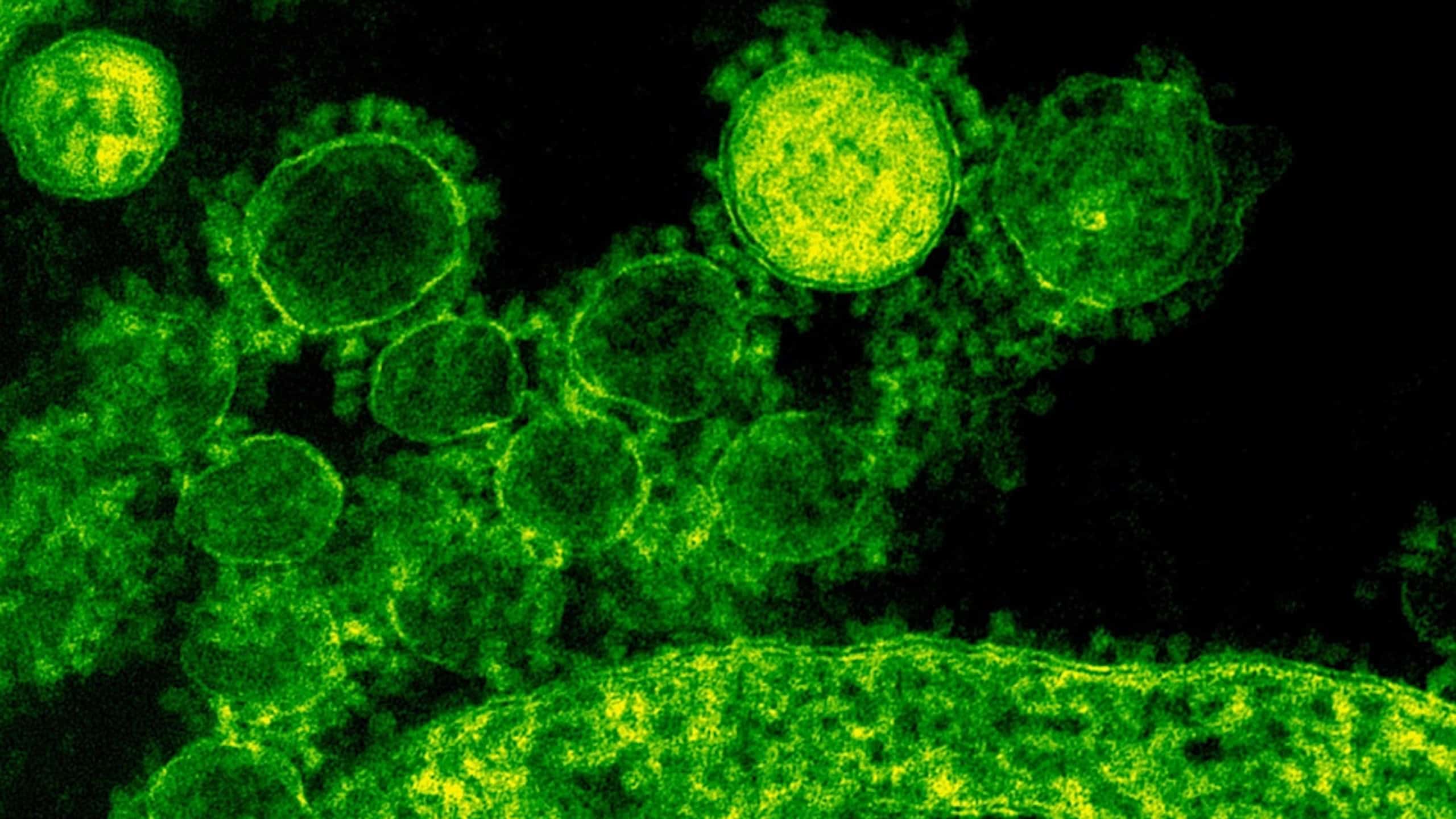 Green coronavirus under a microscope. Photo of virus infection.