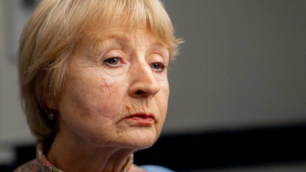 close up In a plastic surgery clinic a doctor makes markings on the face of an elderly woman before a facelift