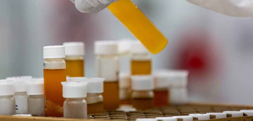 Thc Testing