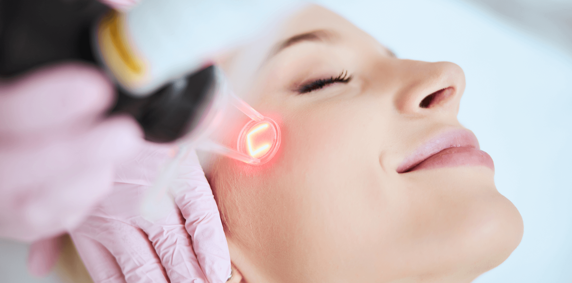 skin laser