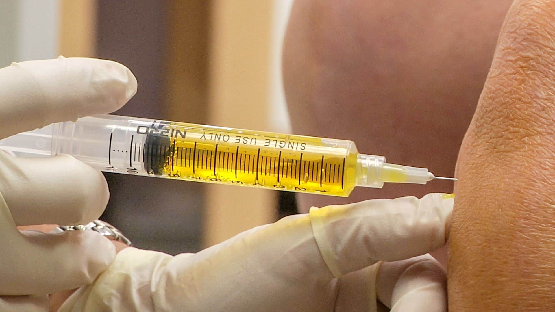 how often can you get PRP injections in your knee 2