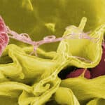 Enterisol® Ileitis proved to be effective against Salmonella