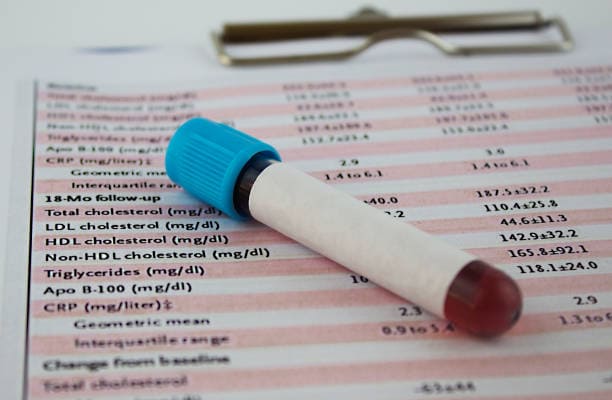 Cholesterol Test Kits Market